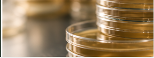 Amber-toned Petri dishes on a laboratory bench